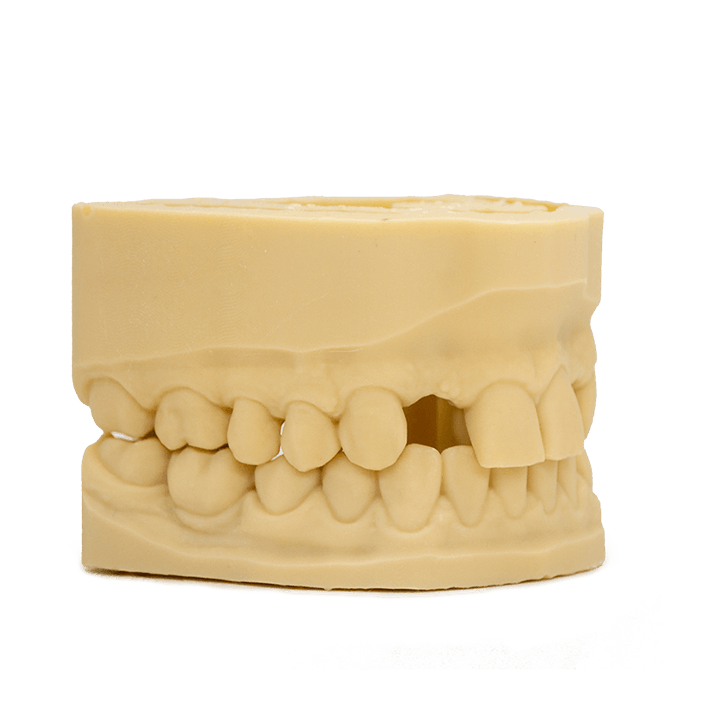 AmeraLabs 3D printing resin dental models